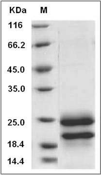 Rat IFN-alpha / IFNA1 / IFN Protein (His Tag) SDS-PAGE