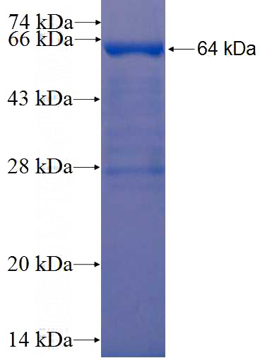Recombinant Human RNPC3 SDS-PAGE