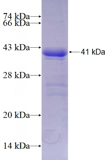 Recombinant Human FOXO3A SDS-PAGE