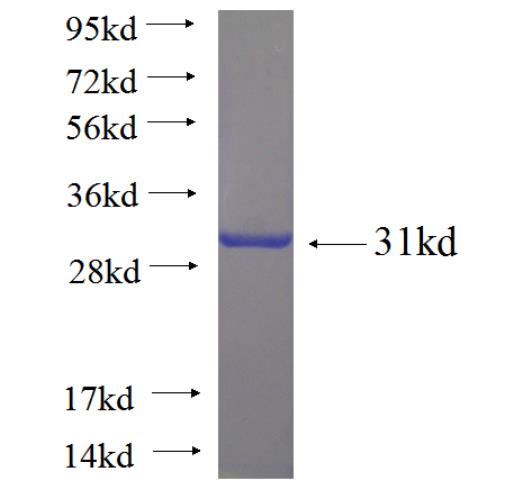 Recombinant human ZNF396 SDS-PAGE