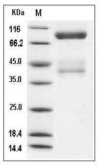 Canine c-MET / HGFR Protein (His Tag) SDS-PAGE