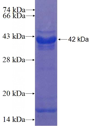Recombinant Human KLHL10 SDS-PAGE