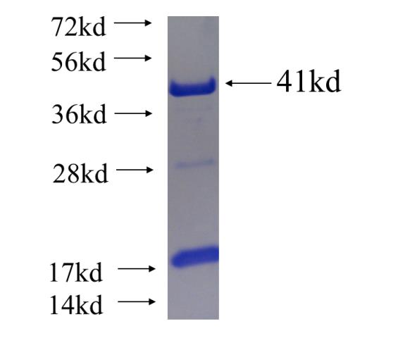 Recombinant human KIAA1217 SDS-PAGE