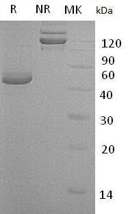 Human TNFRSF10B/DR5/KILLER (Fc & His tag) recombinant protein