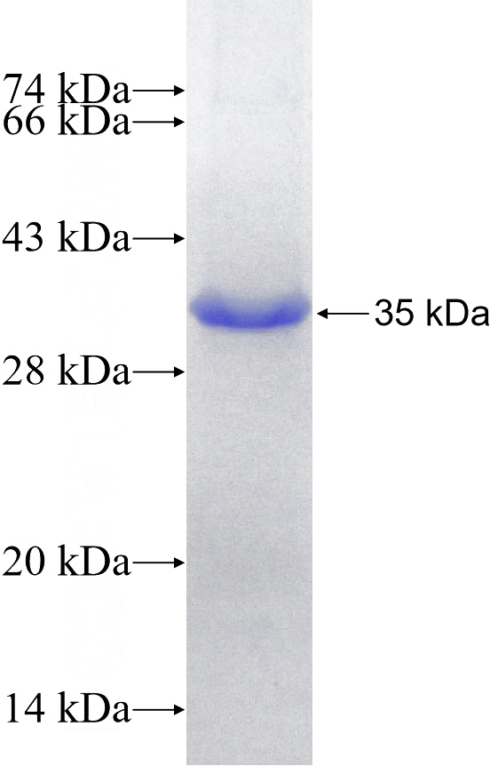 Recombinant Human Parkin SDS-PAGE
