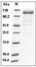 Human IL-35 (IL12A & IL27B) Protein (Fc Tag) SDS-PAGE