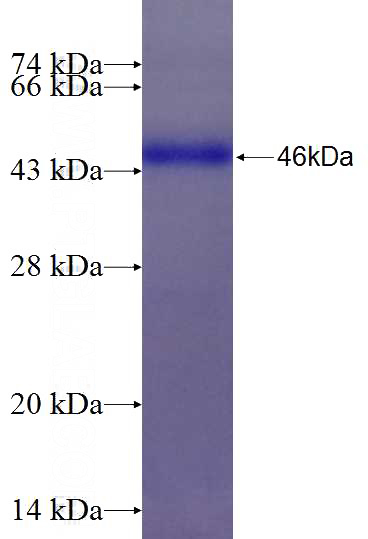 Recombinant Human FLJ11506 SDS-PAGE