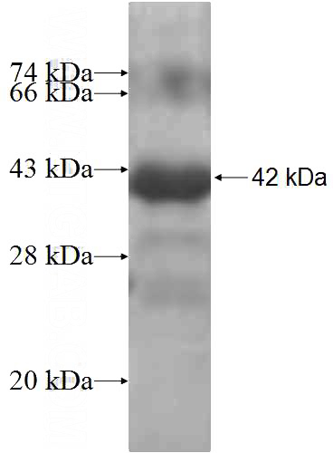Recombinant Human MYLIP SDS-PAGE