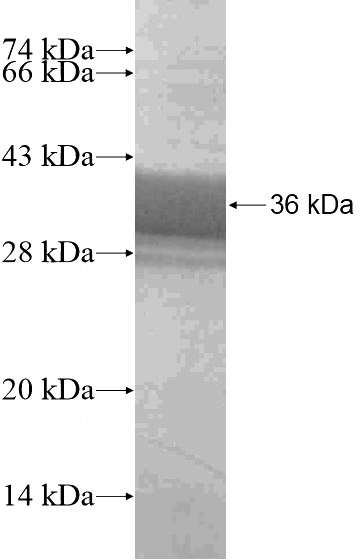 Recombinant Human TPPP SDS-PAGE