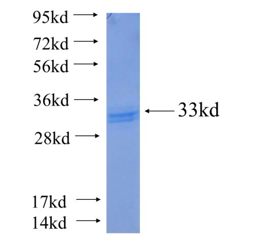 Recombinant human LPAR4 SDS-PAGE