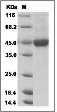 Mouse IL18RAP / IL1R7 Protein (His Tag) SDS-PAGE