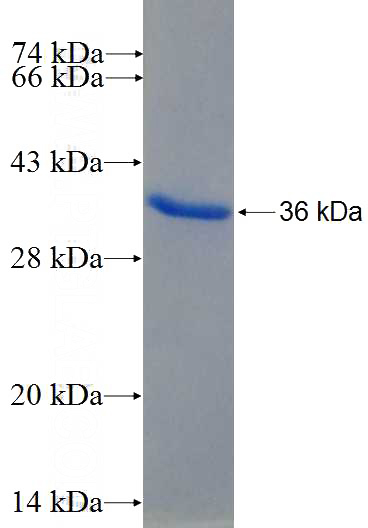 Recombinant Human SOX4 SDS-PAGE