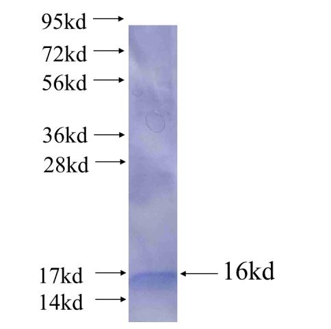 Recombinant human SLC37A4 SDS-PAGE