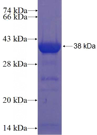 Recombinant Human C11orf74 SDS-PAGE