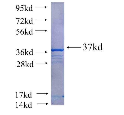 Recombinant human LCA5 SDS-PAGE