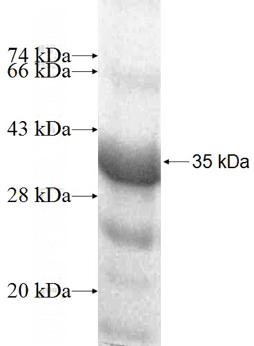 Recombinant Human MESP1 SDS-PAGE
