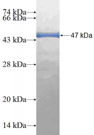 Recombinant Human C1orf93 SDS-PAGE