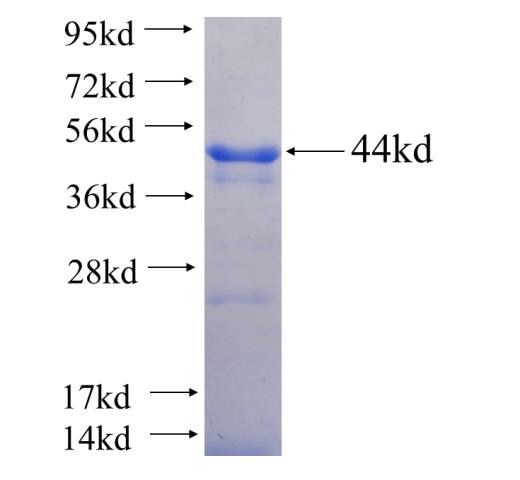 Recombinant human RPAP1 SDS-PAGE