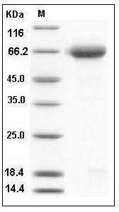 Mouse Nogo Receptor / NOGOR / RTN4R Protein (His Tag) SDS-PAGE