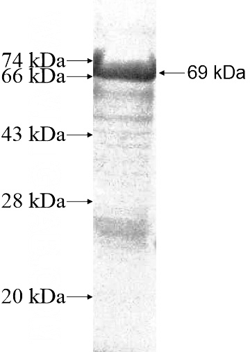 Recombinant Human ZBTB4 SDS-PAGE