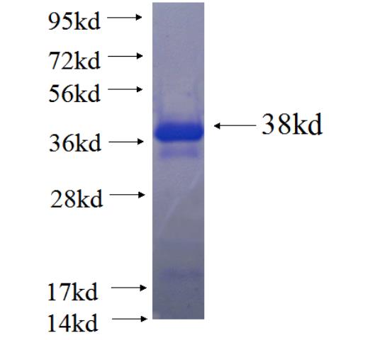 Recombinant human TJP2 SDS-PAGE