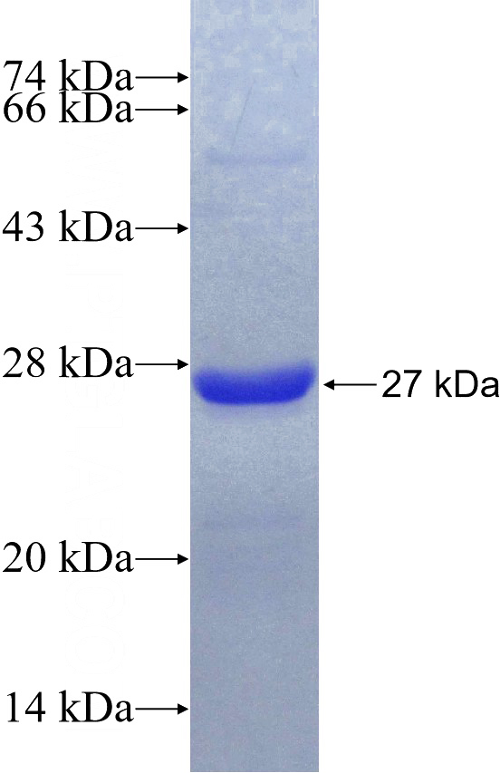 Recombinant Human RAD52 SDS-PAGE