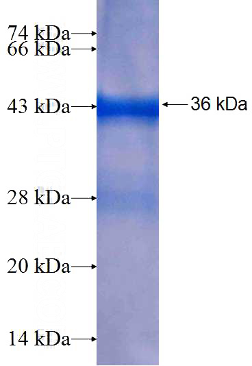 Recombinant Human DUSP23 SDS-PAGE