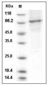 Human PDE2A / CGS-PDE Protein (aa 215-900, His Tag) SDS-PAGE
