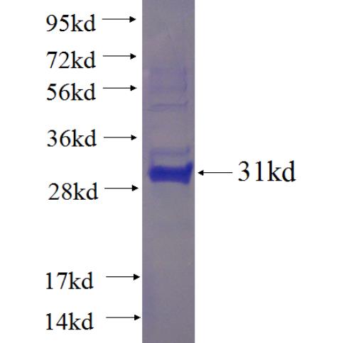 Recombinant human C9orf9 SDS-PAGE