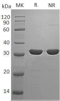 Human CA13 (His tag) recombinant protein
