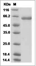 Influenza A H4N6 (A/mallard/Ohio/657/2002) Neuraminidase / NA Protein (His Tag)