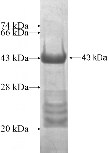Recombinant Human WAC SDS-PAGE