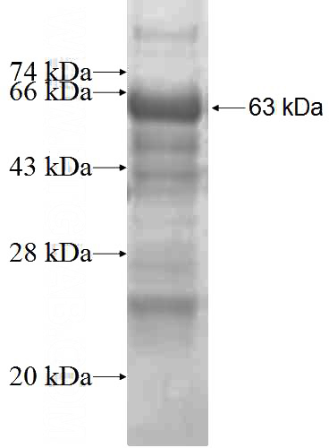 Recombinant Human TCF19 SDS-PAGE