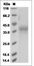 Rhesus PD-1 / CD279 Protein (His Tag) SDS-PAGE