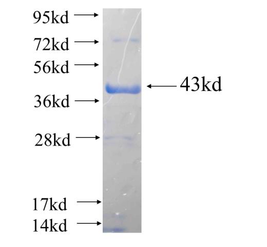 Recombinant human PRKCG SDS-PAGE