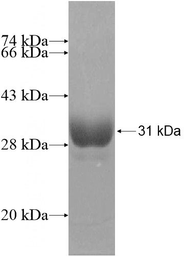 Recombinant Human SAMD3 SDS-PAGE