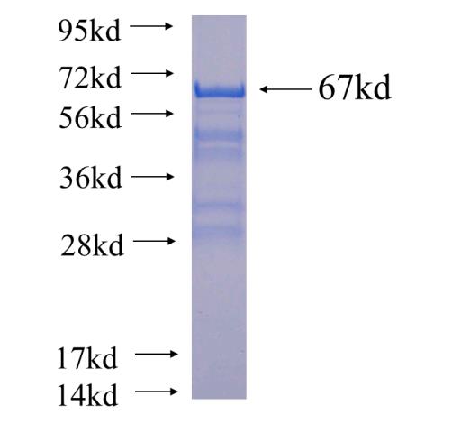 Recombinant human TADA3L SDS-PAGE