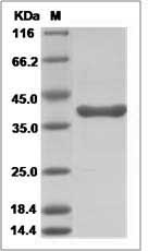 Human ARG1 / Arginase 1 Protein (His & MYC Tag)