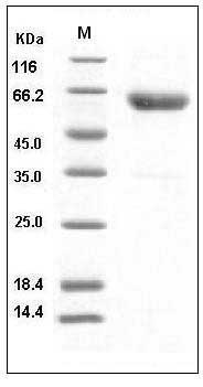 Mouse CD28 Protein (His & Fc Tag) SDS-PAGE