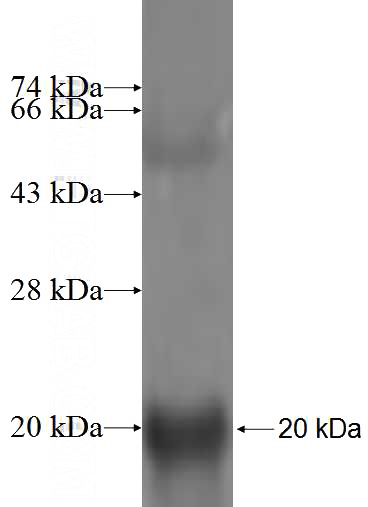 Recombinant Human ZNRD1 SDS-PAGE