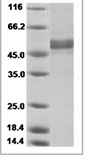 Human IL-17C/IL17C Protein 15489