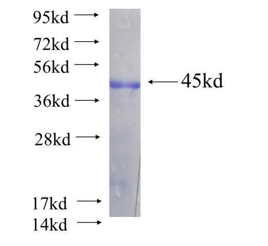 Recombinant human PDGFD(Full length) SDS-PAGE