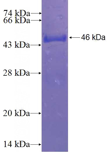 Recombinant Human ARL4A SDS-PAGE