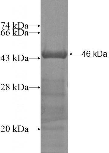 Recombinant Human ARHGAP12 SDS-PAGE