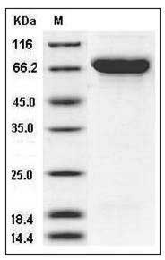 Human Semaphorin 4A / SEMA4A / Semaphorin B Protein (His Tag) SDS-PAGE