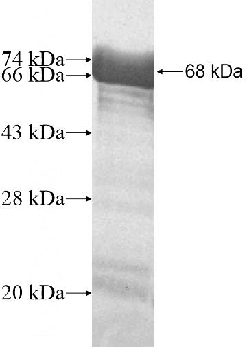 Recombinant Human N4BP3 SDS-PAGE