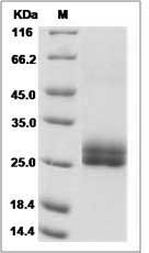 Rat AMBP / Alpha 1 microglobulin Protein (His Tag)