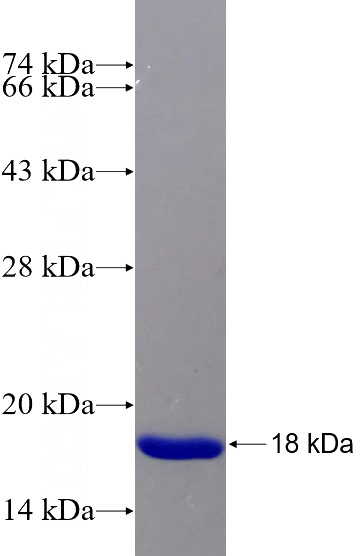 Recombinant Human CEP164 SDS-PAGE