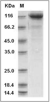 Mouse CDCP1 Protein (Fc Tag) SDS-PAGE