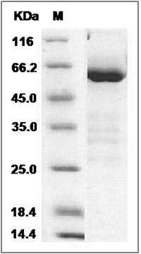 Rat CD73 / NT5E Protein (His Tag) SDS-PAGE